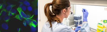Glioblastoma cancer cells and researcher
