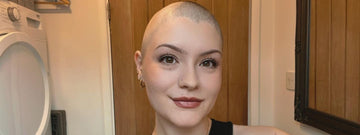Brain Tumour Research supporter Tianna Davies who is living with brain cancer models her shaved head