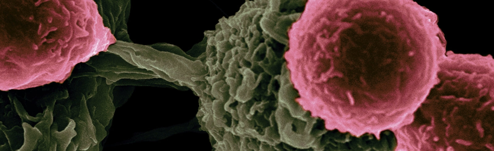 Experimental nasal spray could deliver drugs across the blood-brain ba Brain Tumour Research Experimental nasal spray could deliver drugs across the blood-brain ba Brain Tumour Research